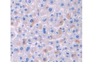 Used in DAB staining on fromalin fixed paraffin- embedded liver tissue (BCR 抗体  (AA 1042-1268))