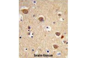 Immunohistochemistry (IHC) image for anti-Apoptosis-Inducing Factor, Mitochondrion-Associated, 1 (AIFM1) antibody (ABIN3003960)