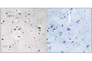 Immunohistochemistry analysis of paraffin-embedded human brain tissue, using ZNF7 Antibody. (ZNF7 抗体  (AA 41-90))