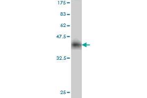 Western Blotting (WB) image for anti-Ligase I, DNA, ATP-Dependent (LIG1) (AA 810-919) antibody (ABIN561671)