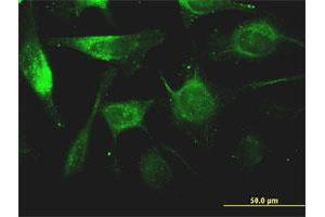 Immunofluorescence of monoclonal antibody to FTL on HeLa cell. (FTL 抗体)