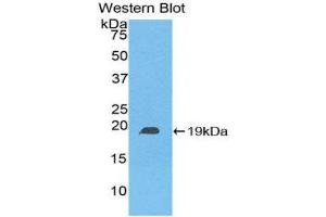 Western Blotting (WB) image for anti-Heat Shock Protein, alpha-Crystallin-Related, B6 (HSPB6) (AA 1-162) antibody (ABIN1078125)