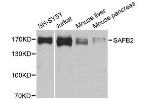Western blot analysis of extracts of various cell lines, using SAFB2 antibody. (SAFB2 抗体  (AA 1-255))
