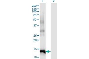 Western Blot analysis of CDKN2B expression in transfected 293T cell line by CDKN2B monoclonal antibody (M07), clone 8C4. (CDKN2B 抗体  (AA 1-138))