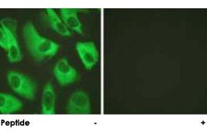Immunofluorescence analysis of HeLa cells, using KCNJ16 polyclonal antibody .