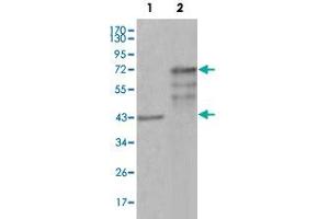 Western blot analysis using CHIT1 monoclonal antibody, clone 1D9G2  against truncated Trx-CHIT1 recombinant protein (1) and truncated CHIT1 (aa22-466)-hIgGFc transfected CHO-K1 cell lysate (2). (Chitotriosidase 1 抗体)
