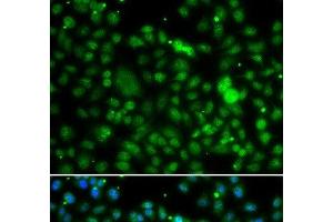 Immunofluorescence analysis of MCF-7 cells using NSUN6 Polyclonal Antibody (NSUN6 抗体)