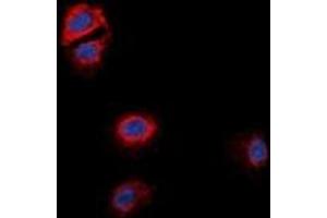 Immunofluorescent analysis of GPR170 staining in MCF7 cells. (OXER1 抗体)