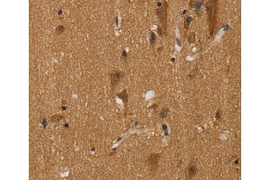 Immunohistochemistry (IHC) image for anti-Nerve Growth Factor Receptor (TNFRSF16) Associated Protein 1 (NGFRAP1) antibody (ABIN2430497)