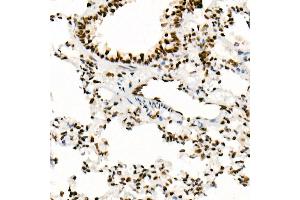 Immunohistochemistry (IHC) image for anti-SWI/SNF Related, Matrix Associated, Actin Dependent Regulator of Chromatin, Subfamily B, Member 1 (SMARCB1) antibody (ABIN7270657)