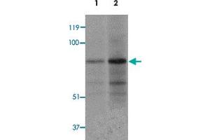 Western blot analysis of EZH1 in mouse lung tissue lysate with EZH1 polyclonal antibody  at 1 ug/mL (lane 1) and 2 ug/mL (lane 2). (EZH1 抗体  (N-Term))
