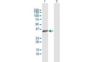 Western Blot analysis of ITPK1 expression in transfected 293T cell line by ITPK1 MaxPab polyclonal antibody. (ITPK1 抗体  (AA 1-314))