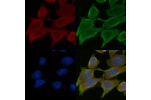 ABIN7095313 and ABIN7099370 staining Hela cells(45 min of heat-shock treatment) by IF/ICC. (C2CD2 抗体)