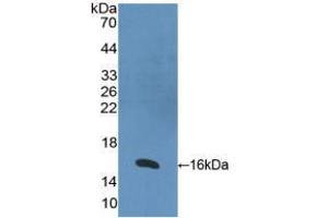 Western blot analysis of recombinant Human RARa. (Retinoic Acid Receptor alpha 抗体  (AA 68-173))