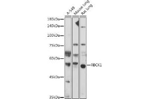 RBCK1 抗体