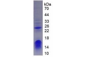 SDS-PAGE analysis of Human CHD3 Protein. (CHD3 蛋白)