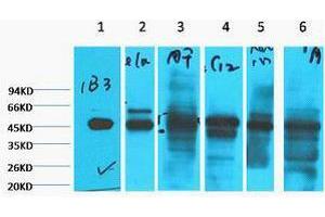 Western Blotting (WB) image for anti-Keratin 18 (KRT18) antibody (ABIN3178648) (Cytokeratin 18 抗体)