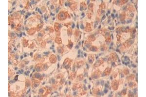 Detection of CYR61 in Human Stomach Tissue using Polyclonal Antibody to Cysteine Rich Protein, Angiogenic Inducer 61 (CYR61) (CYR61 抗体  (AA 178-381))