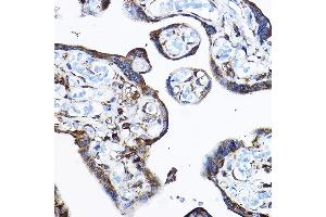 Immunohistochemistry (IHC) image for anti-Ribosomal Protein L17 (RPL17) (AA 1-184) antibody (ABIN6147115)