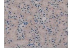 IHC-P analysis of Mouse Kidney Tissue, with DAB staining. (TICAM1 抗体  (AA 263-526))