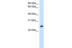 Western Blotting (WB) image for anti-gamma-Glutamyltransferase Light Chain 1 (GGTLC1) antibody (ABIN2462441) (GGTLC1 抗体)