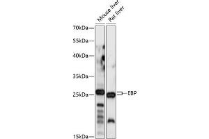 Western blot analysis of extracts of various cell lines, using EBP antibody (ABIN7266934) at 1:1000 dilution. (EBP 抗体  (AA 50-150))
