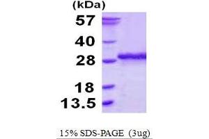 SSU72 RNA Polymerase II CTD Phosphatase Homolog (SSU72) (AA 1-194) protein (His tag)