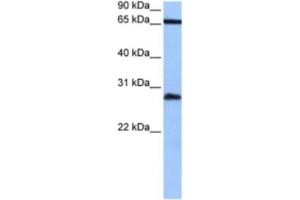 Western Blotting (WB) image for anti-Homeobox C6 (HOXC6) antibody (ABIN2463858) (Homeobox C6 抗体)