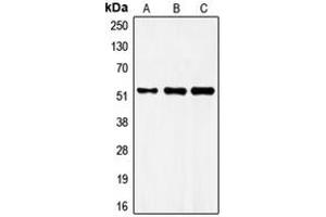 Western blot analysis of FRS3 expression in MCF7 (A), mouse brain (B), rat brain (C) whole cell lysates. (FRS3 抗体  (Center))