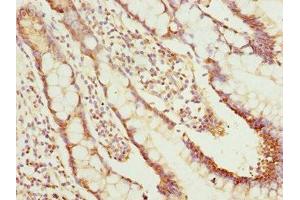 Immunohistochemistry of paraffin-embedded human small intestine tissue using ABIN7161726 at dilution of 1:100 (NLE1 抗体  (AA 206-485))