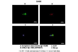 Immunohistochemistry (IHC) image for anti-Growth Arrest-Specific 8 (GAS8) (Middle Region) antibody (ABIN2783195) (GAS8 抗体  (Middle Region))