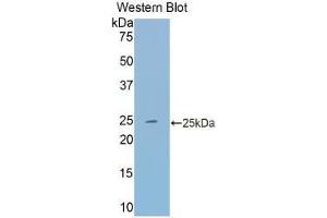 Western blot analysis of the recombinant protein. (Transferrin 抗体  (AA 22-176))