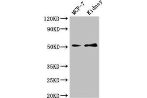 Western Blot Positive WB detected in: MCF-7 whole cell lysate, Mouse kidney tissue All lanes: GFRA1 antibody at 3 μg/mL Secondary Goat polyclonal to rabbit IgG at 1/50000 dilution Predicted band size: 52, 51 kDa Observed band size: 52 kDa (GFRA1 抗体  (AA 230-385))