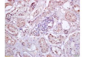 Formalin-fixed and paraffin embedded human kidney labeled with Anti-IRF3 Polyclonal Antibody, Unconjugated (ABIN682588) at 1:200 followed by conjugation to the secondary antibody and DAB staining (IRF3 抗体  (AA 51-150))