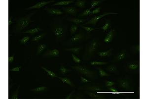 Immunofluorescence of monoclonal antibody to BAG5 on HeLa cell. (BAG5 抗体  (AA 1-447))