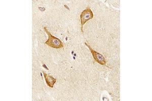 Immunohistochemistry (Paraffin-embedded Sections) (IHC (p)) image for anti-Phosphatidylinositol-5-Phosphate 4-Kinase, Type II, alpha (PIP4K2A) (AA 329-363), (C-Term) antibody (ABIN6243276)