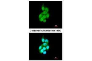ICC/IF Image Immunofluorescence analysis of methanol-fixed A431, using BAIAP2L1, antibody at 1:200 dilution. (BAIAP2L1 抗体)