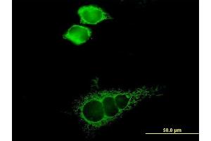 Immunofluorescence of purified MaxPab antibody to SLC16A1 on HeLa cell.