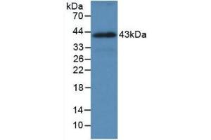Detection of Recombinant HSPA1A, Human using Monoclonal Antibody to Heat Shock 70 kDa Protein 1A (HSPA1A) (HSP70 1A 抗体  (AA 285-641))