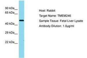 Image no. 1 for anti-Transmembrane Protein 246 (TMEM246) (AA 152-201) antibody (ABIN6750482) (TMEM246 抗体  (AA 152-201))