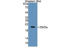 Detection of Recombinant DTYMK, Human using Polyclonal Antibody to Deoxythymidylate Kinase (DTYMK) (DTYMK 抗体  (AA 43-190))