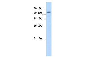 Lane: HepG2 cell lysate. (Glucuronidase beta 抗体  (C-Term))