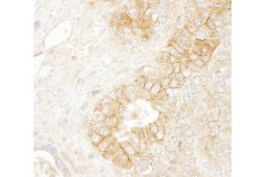Immunohistochemistry (IHC) image for anti-Catenin, beta (CATNB) (AA 760-781) antibody (ABIN7448432) (beta Catenin 抗体  (AA 760-781))
