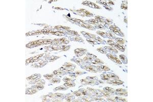 Immunohistochemistry of paraffin-embedded mouse stomach using IER3 antibody at dilution of 1:100 (x40 lens). (IER3 抗体)