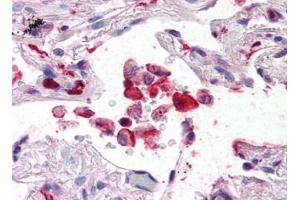 Image no. 1 for anti-Ionized Calcium-binding Adapter Molecule 1 (IBA1) (C-Term) antibody (ABIN492698) (Iba1 抗体  (C-Term))