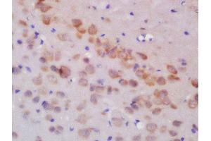 Formalin-fixed and paraffin embedded rat brain labeled with Rabbit Anti-GLUR3 Polyclonal Antibody, Unconjugated  at 1:200 followed by conjugation to the secondary antibody and DAB staining (Glutamate Receptor 3 抗体  (AA 451-550))