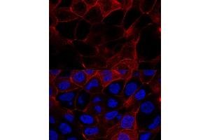 Confocal immunofluorescence analysis of  cells using CD44 antibody (ABIN6127602, ABIN6138193, ABIN6138195 and ABIN7101398) at dilution of 1:200. (CD44 抗体  (AA 148-247))