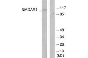 Western blot analysis of extracts from Jurkat cells, using NMDAR1 (Ab-897) Antibody.