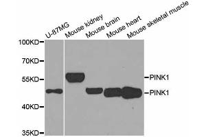 Western blot analysis of extracts of various cell lines, using PINK1 antibody (ABIN5974289) at 1/1000 dilution. (PINK1 抗体)