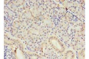 Immunohistochemistry of paraffin-embedded human pancreatic tissue using ABIN7170741 at dilution of 1:100 (SAMD3 抗体  (AA 62-197))